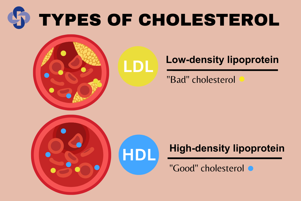 Cholesterol: The Good and the Bad